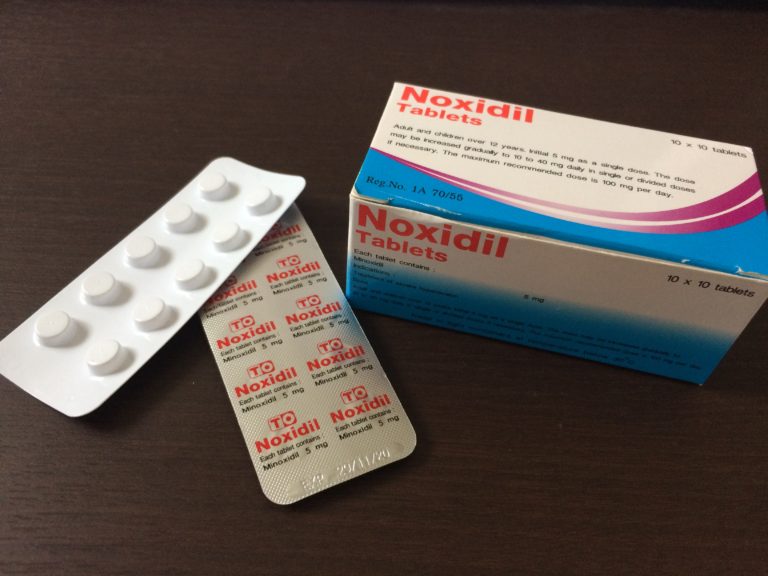 Noxidil（ミノキシジル内服薬）をやめて約3か月経過しました。 海外仕入れとネットショップ運営のブログ